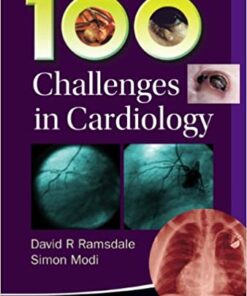 100 Challenges In Cardiology