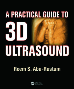 A Practical Guide to 3D Ultrasound