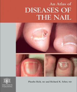 An Atlas of Diseases of the Nail