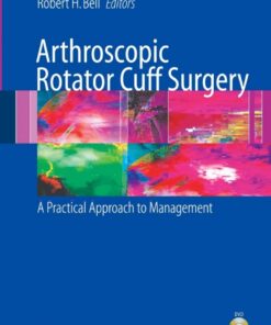 Arthroscopic Rotator Cuff Surgery: A Practical Approach to Management