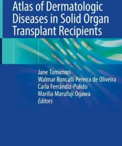 Atlas of Dermatologic Diseases in Solid Organ Transplant Recipients