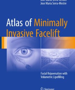 Atlas of Minimally Invasive Facelift: Facial Rejuvenation with Volumetric Lipofilling