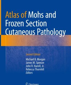 Atlas of Mohs and Frozen Section Cutaneous Pathology