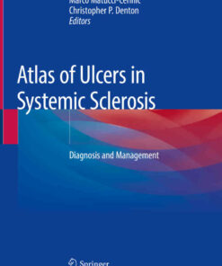 Atlas of Ulcers in Systemic Sclerosis: Diagnosis and Management