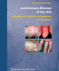 Autoimmune Diseases of the Skin: Pathogenesis Diagnosis Management