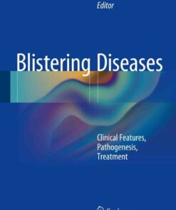 Blistering Diseases: Clinical Features Pathogenesis Treatment