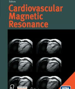 Cardiovascular Magnetic Resonance