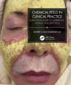 Chemical Peels in Clinical Practice: A Practical Guide to Superficial Medium and Deep Peels