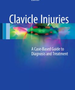 Clavicle Injuries: A Case-Based Guide to Diagnosis and Treatment