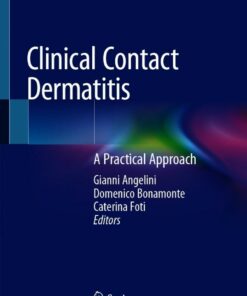 Clinical Contact Dermatitis: A Practical Approach