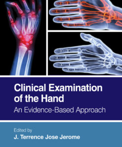 Clinical Examination of the Hand: An Evidence-Based Approach