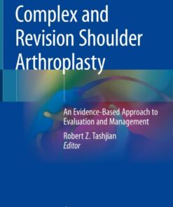 Complex and Revision Shoulder Arthroplasty: An Evidence-Based Approach to Evaluation and Management