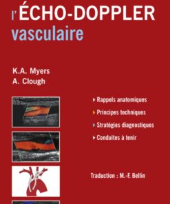 Comprendre l'Echo-Doppler vasculaire