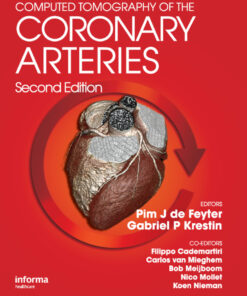 Computed Tomography of the Coronary Arteries