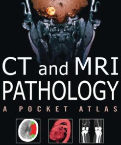 CT & MRI Pathology: A Pocket Atlas Second Edition