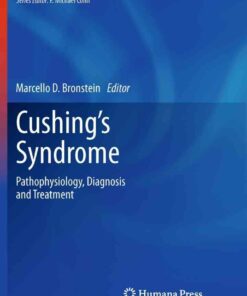 Cushing's Syndrome: Pathophysiology Diagnosis and Treatment