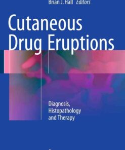 Cutaneous Drug Eruptions: Diagnosis Histopathology and Therapy