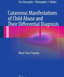 Cutaneous Manifestations of Child Abuse and Their Differential Diagnosis: Blunt Force Trauma