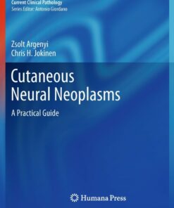 Cutaneous Neural Neoplasms: A Practical Guide