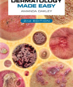 Dermatology Made Easy
