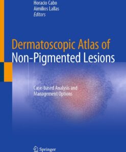 Dermatoscopic Atlas of Non-Pigmented Lesions: Case-based Analysis and Management Options