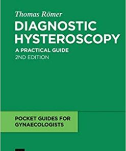 Diagnostic Hysteroscopy: A practical guide