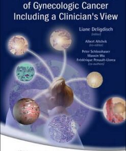 Early Pathologic Diagnosis of Gynecologic Cancer Including a Clinician's View