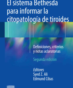 El sistema Bethesda para informar la citopatolog?a de tiroides: Definiciones criterios y notas aclaratorias