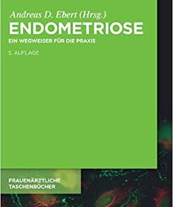 Endometriose: Ein Wegweiser f�r die Praxis