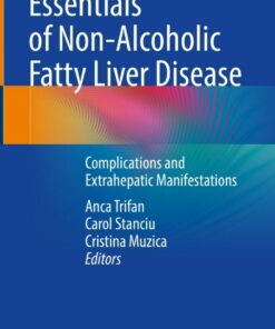 Essentials of Non-Alcoholic Fatty Liver Disease: Complications and Extrahepatic Manifestations