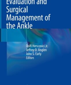 Evaluation and Surgical Management of the Ankle