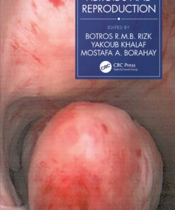 Fibroids and Reproduction