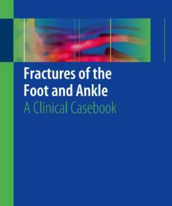 Fractures of the Foot and Ankle: A Clinical Cas
