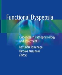 Functional Dyspepsia: Evidences in Pathophysiology and Treatment