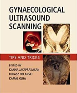 Gynaecological Ultrasound Scanning: Tips and Tricks