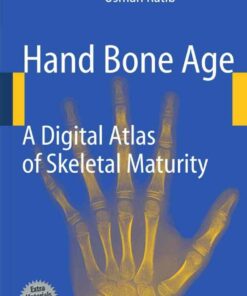 Hand Bone Age: A Digital Atlas of Skeletal Maturity