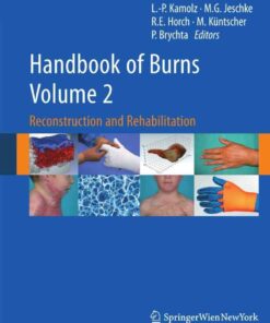 Handbook of Burns Volume 2: Reconstruction and Rehabilitation