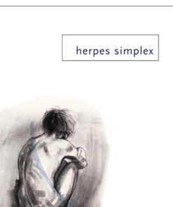 Herpes Simplex