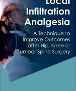 Local Infiltration Analgesia: A Technique to Improve Outcomes after Hip Knee or Lumbar Spine Surgery