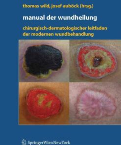 Manual der Wundheilung: Chirurgisch-dermatologischer Leitfaden der modernen Wundbehandlung
