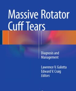 Massive Rotator Cuff Tears: Diagnosis and Management