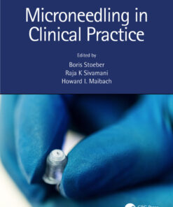 Microneedling in Clinical Practice
