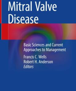 Mitral Valve Disease: Basic Sciences and Current Approaches to Management