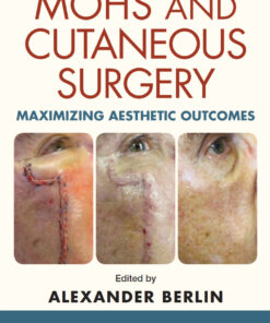 Mohs and Cutaneous Surgery: Maximizing Aesthetic Outcomes