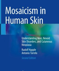 Mosaicism in Human Skin: Understanding Nevi Nevoid Skin Disorders and Cutaneous Neoplasia