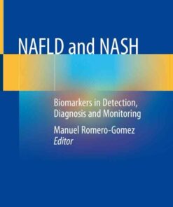 NAFLD and NASH: Biomarkers in Detection Diagnosis and Monitoring