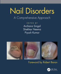 Nail Disorders: A Comprehensive Approach