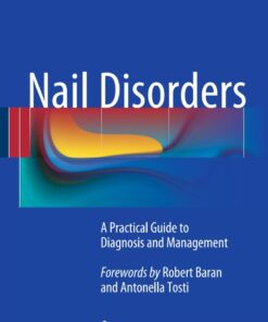 Nail Disorders: A Practical Guide to Diagnosis and Management