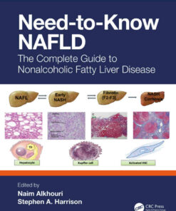 Need-to-Know NAFLD: The Complete Guide to Nonalcoholic Fatty Liver Disease