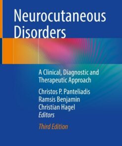 Neurocutaneous Disorders: A Clinical Diagnostic and Therapeutic Approach